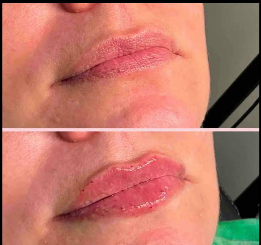 medicube PDRN Pink Collagen Volume Multi Balm Stick