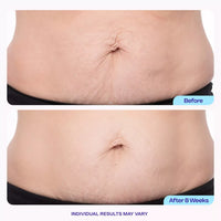 goPure Belly Firming Cream — Tighten & Smooth for Stretch Marks, 4.25 fl oz
