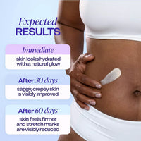 goPure Belly Firming Cream — Tighten & Smooth for Stretch Marks, 4.25 fl oz
